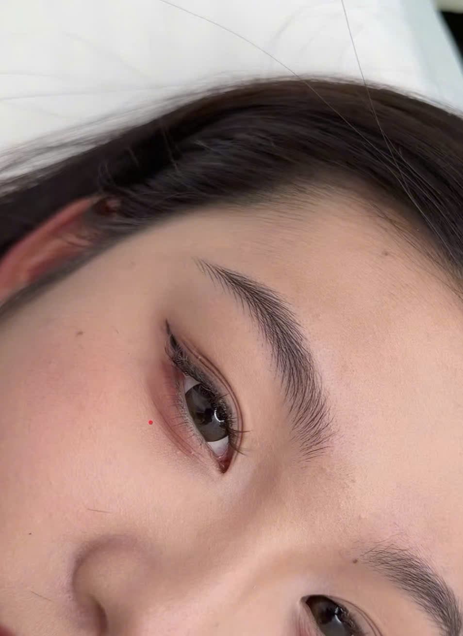 Laser, môi, mày và phục hồi theo tình trạng riêng